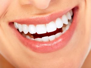 What Are The Best Options for Straightening Your Teeth?