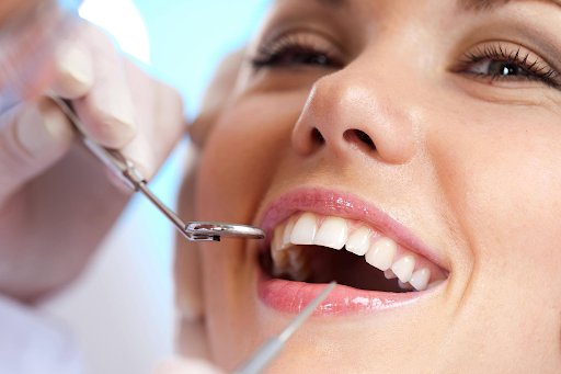 What are the costs involved in a dental filling?